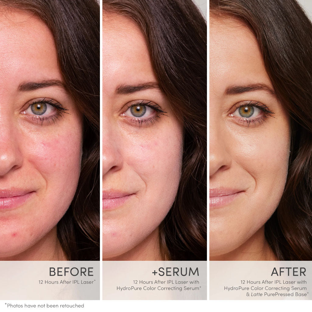Before and after comparison of a woman's face with serum application, showing skin improvement.