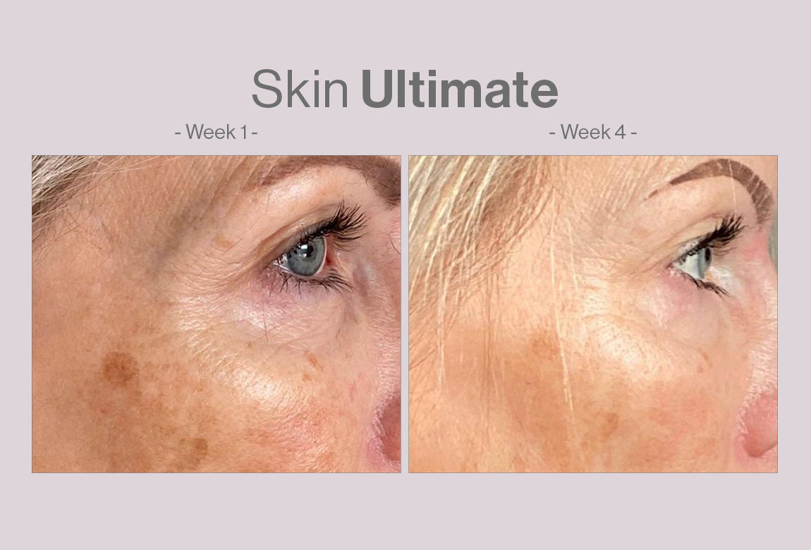 a before and after image, showing difference form taking skin ultimate