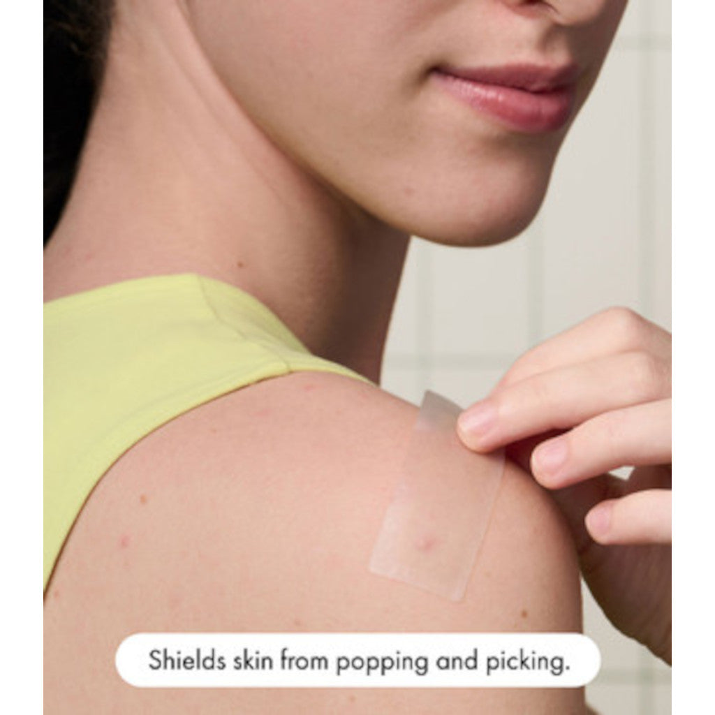 Hero Mighty Patch Surface 10s