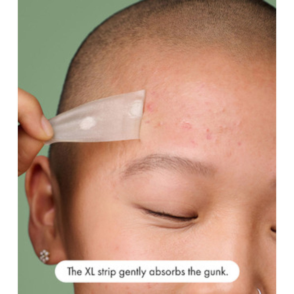 Hero Mighty Patch Surface 10s