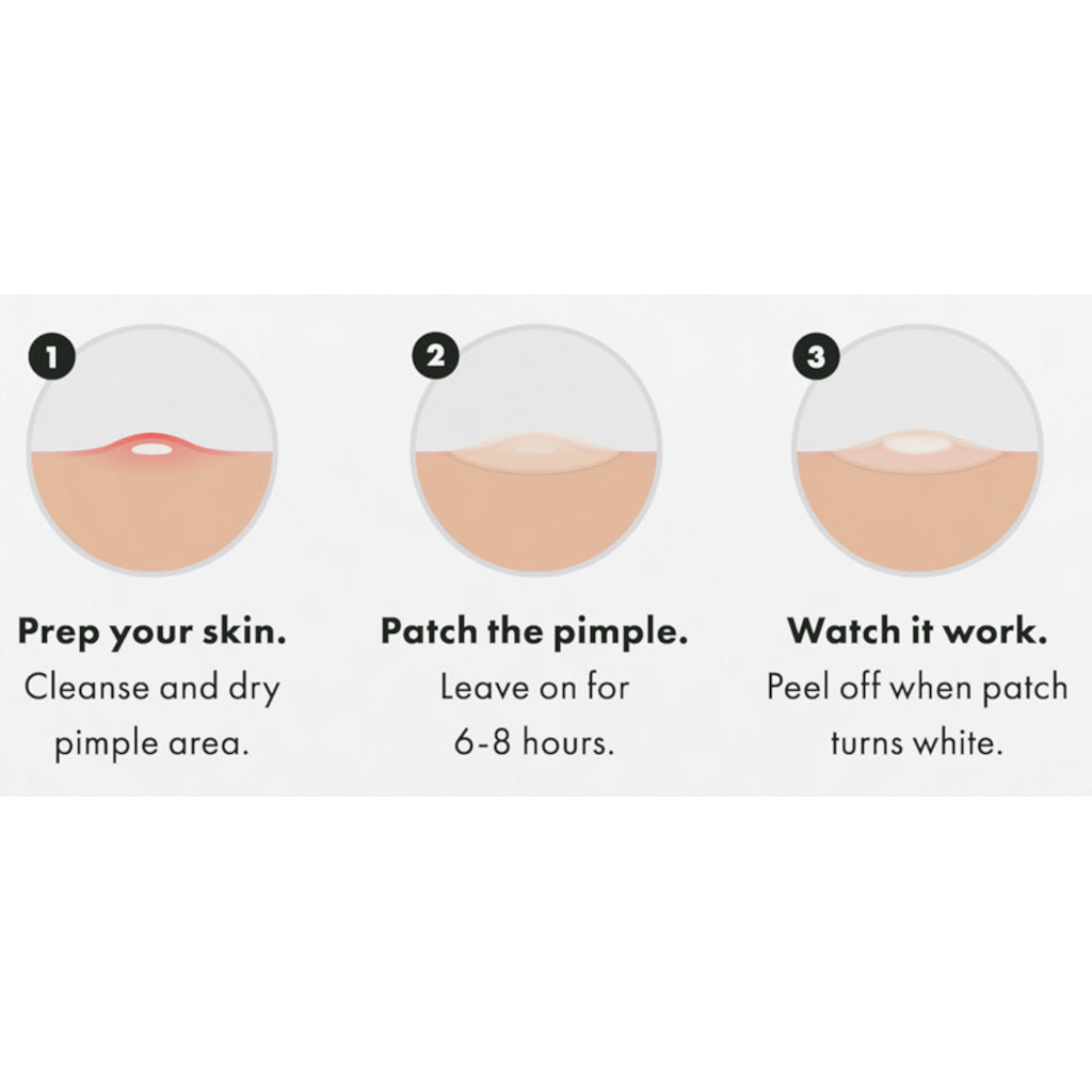 Hero Mighty Patch Surface 10s