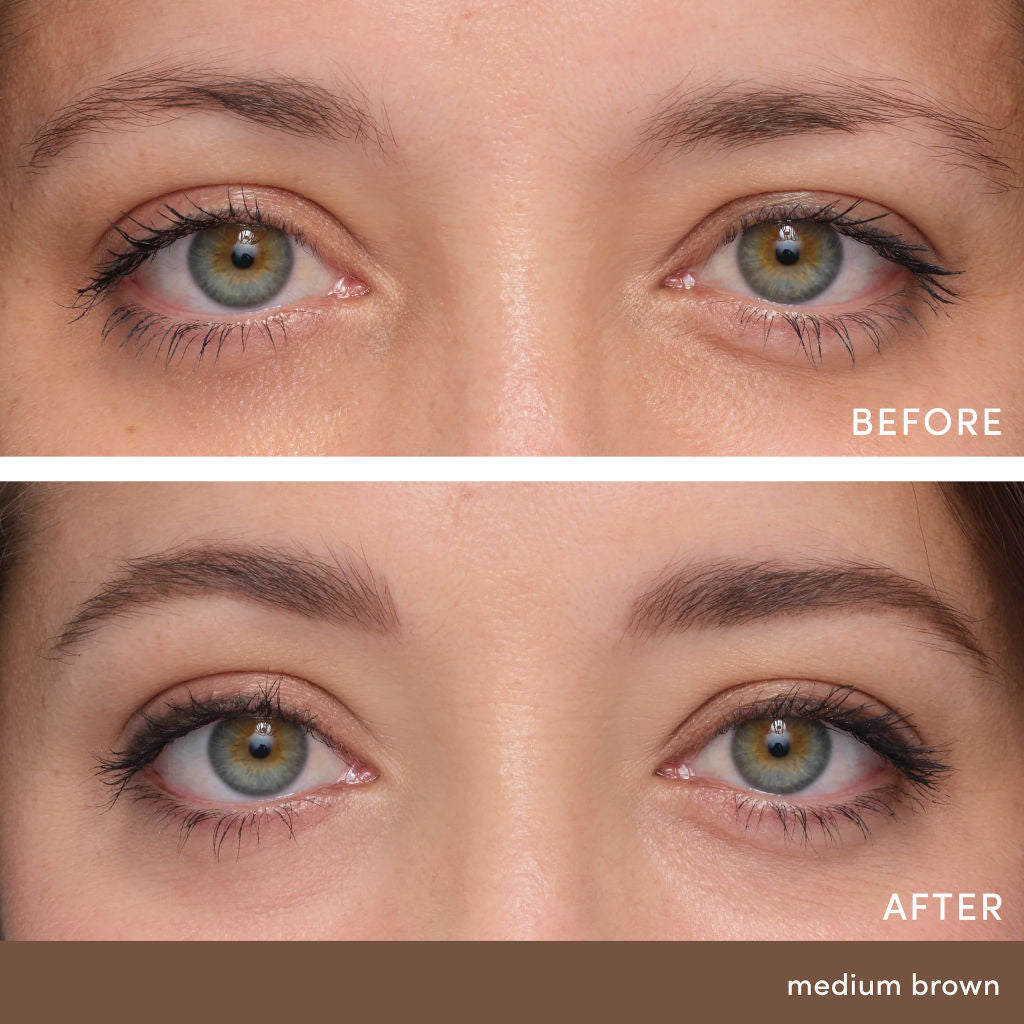 Before and after comparison of a woman's eyes with medium brown coloration.