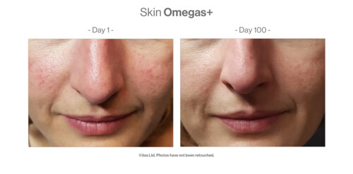 Advanced Nutrition Programme Case Study Results Skin Omegas